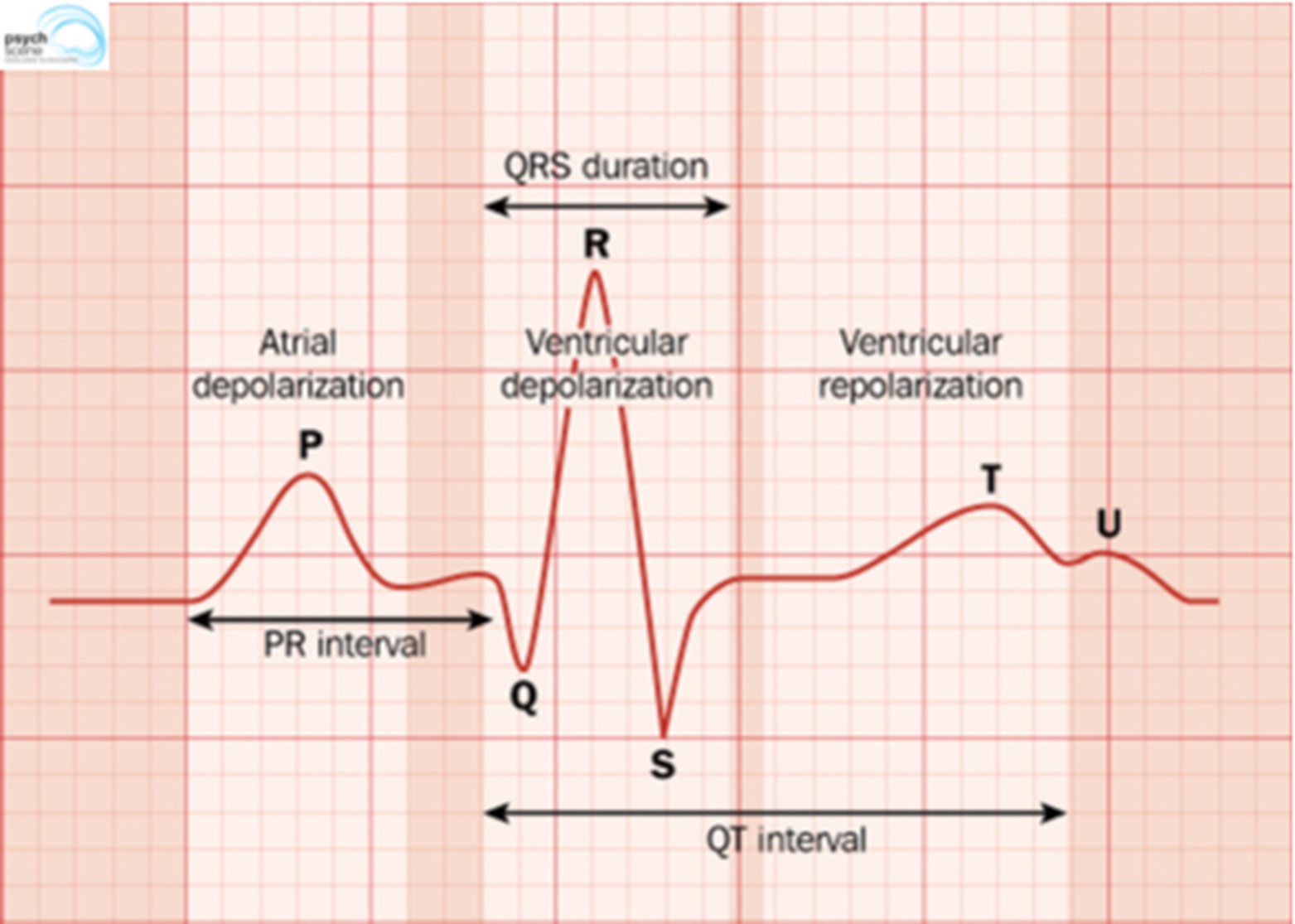 Skipping a Beat Hormones and Heart Palpitations ZRT Laboratory