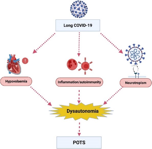 Catecholamines, Cortisol And Long COVID